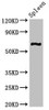 Western Blot<br />
 Positive WB detected in: Mouse spleen tissue<br />
 All lanes: CNKSR3 antibody at 2µg/ml<br />
 Secondary<br />
 Goat polyclonal to rabbit IgG at 1/50000 dilution<br />
 Predicted band size: 62, 101, 93 kDa<br />
 Observed band size: 62 kDa<br />