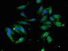 Immunofluorescent analysis of Hela cells using CSB-PA836199LA01HU at dilution of 1:100 and Alexa Fluor 488-congugated AffiniPure Goat Anti-Rabbit IgG (H+L)