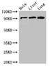 Western Blot<br />
 Positive WB detected in: Hela whole cell lysate, Mouse liver tissue, Mouse lung tissue<br />
 All lanes: CPT1C antibody at 2.6µg/ml<br />
 Secondary<br />
 Goat polyclonal to rabbit IgG at 1/50000 dilution<br />
 Predicted band size: 91, 90, 81 kDa<br />
 Observed band size: 91 kDa<br />