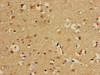 Immunohistochemistry of paraffin-embedded human brain tissue using CSB-PA855048LA01HU at dilution of 1:100