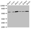 Western Blot<br />
 Positive WB detected in: Rat heart tissue, Rat liver tissue, Mouse heart tissue, Mouse liver tissue, Mouse kidney tissue, Mouse brain tissue<br />
 All lanes: CREB3L1 antibody at 3.4µg/ml<br />
 Secondary<br />
 Goat polyclonal to rabbit IgG at 1/50000 dilution<br />
 Predicted band size: 58, 48 kDa<br />
 Observed band size: 58 kDa<br />