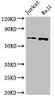 Western Blot<br />
 Positive WB detected in: Jurkat whole cell lysate, Raji whole cell lysate<br />
 All lanes: CDC6 antibody at 2.5µg/ml<br />
 Secondary<br />
 Goat polyclonal to rabbit IgG at 1/50000 dilution<br />
 Predicted band size: 63 kDa<br />
 Observed band size: 63 kDa<br />