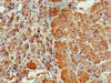 Immunohistochemistry of paraffin-embedded human adrenal gland tissue using CSB-PA857873LA01HU at dilution of 1:100