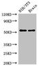 Western Blot<br />
 Positive WB detected in: NIH/3T3 whole cell lysate, Mouse brain tissue<br />
 All lanes: OLFM1 antibody at 2.5µg/ml<br />
 Secondary<br />
 Goat polyclonal to rabbit IgG at 1/50000 dilution<br />
 Predicted band size: 56, 18, 55, 16, 53 kDa<br />
 Observed band size: 56 kDa<br />