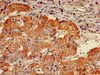 IHC image of CSB-PA860773LA01HU diluted at 1:600 and staining in paraffin-embedded human adrenal gland tissue performed on a Leica BondTM system. After dewaxing and hydration, antigen retrieval was mediated by high pressure in a citrate buffer (pH 6.0) . Section was blocked with 10% normal goat serum 30min at RT. Then primary antibody (1% BSA) was incubated at 4°C overnight. The primary is detected by a biotinylated secondary antibody and visualized using an HRP conjugated SP system.