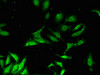 Immunofluorescent analysis of Hela cells using CSB-PA860773LA01HU at dilution of 1:100 and Alexa Fluor 488-congugated AffiniPure Goat Anti-Rabbit IgG (H+L)