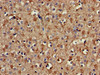 Immunohistochemistry of paraffin-embedded human brain tissue using CSB-PA865102LA01HU at dilution of 1:100