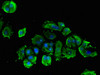 Immunofluorescent analysis of MCF-7 cells using CSB-PA865102LA01HU at dilution of 1:100 and Alexa Fluor 488-congugated AffiniPure Goat Anti-Rabbit IgG (H+L)