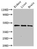 Western Blot<br />
 Positive WB detected in: Rat kidney tissue, Rat liver tissue, Mouse brain tissue<br />
 All lanes: PIPOX antibody at 2.4µg/ml<br />
 Secondary<br />
 Goat polyclonal to rabbit IgG at 1/50000 dilution<br />
 Predicted band size: 45 kDa<br />
 Observed band size: 45 kDa<br /> Western Blot<br />
 Positive WB detected in: Rat kidney tissue, Rat liver tissue, Mouse brain tissue<br />
 All lanes: PIPOX antibody at 2.4µg/ml<br />
 Secondary<br />
 Goat polyclonal to rabbit IgG at 1/50000 dilution<br />
 Predicted band size: 45 kDa<br />
 Observed band size: 45 kDa<br />