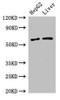 Western Blot<br />
 Positive WB detected in: HepG2 whole cell lysate, Mouse liver tissue<br />
 All lanes: SLC2A9 antibody at 2.7µg/ml<br />
 Secondary<br />
 Goat polyclonal to rabbit IgG at 1/50000 dilution<br />
 Predicted band size: 59, 56 kDa<br />
 Observed band size: 59 kDa<br /> Western Blot<br />
 Positive WB detected in: HepG2 whole cell lysate, Mouse liver tissue<br />
 All lanes: SLC2A9 antibody at 2.7µg/ml<br />
 Secondary<br />
 Goat polyclonal to rabbit IgG at 1/50000 dilution<br />
 Predicted band size: 59, 56 kDa<br />
 Observed band size: 59 kDa<br />