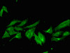 Immunofluorescent analysis of Hela cells using CSB-PA881005LA01HU at dilution of 1:100 and Alexa Fluor 488-congugated AffiniPure Goat Anti-Rabbit IgG (H+L)