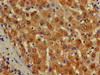 Immunohistochemistry of paraffin-embedded human liver tissue using CSB-PA887126LA01HU at dilution of 1:100