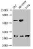 Western Blot<br />
 Positive WB detected in: U87 whole cell lysate, SH-SY5Y whole cell lysate, Rat lung tissue<br />
 All lanes: NEUROG2 antibody at 3µg/ml<br />
 Secondary<br />
 Goat polyclonal to rabbit IgG at 1/50000 dilution<br />
 Predicted band size: 29 kDa<br />
 Observed band size: 29, 60 kDa<br />