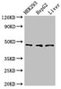 Western Blot<br />
 Positive WB detected in: HEK293 whole cell lysate, HepG2 whole cell lysate, Rat liver tissue<br />
 All lanes: ACADSB antibody at 3µg/ml<br />
 Secondary<br />
 Goat polyclonal to rabbit IgG at 1/50000 dilution<br />
 Predicted band size: 48, 37 kDa<br />
 Observed band size: 48 kDa<br />