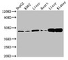 Western Blot<br />
 Positive WB detected in: HepG2 whole cell lysate, K562 whole cell lysate, Rat liver tissue, Mouse heart tissue, Mouse liver tissue Mouse kindey tissue<br />
 All lanes: ACAT1 antibody at 3µg/ml<br />
 Secondary<br />
 Goat polyclonal to rabbit IgG at 1/50000 dilution<br />
 Predicted band size: 46, 18 kDa<br />
 Observed band size: 46 kDa<br />