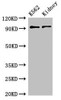 Western Blot<br />
 Positive WB detected in: K562 whole cell lysate, Mouse kidney tissue<br />
 All lanes: AP1G1 antibody at 3.4µg/ml<br />
 Secondary<br />
 Goat polyclonal to rabbit IgG at 1/50000 dilution<br />
 Predicted band size: 92 kDa<br />
 Observed band size: 92 kDa<br />