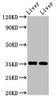 Western Blot<br />
 Positive WB detected in: Mouse liver tissue, Rat liver tissue<br />
 All lanes: ARG1 antibody at 2.8µg/ml<br />
 Secondary<br />
 Goat polyclonal to rabbit IgG at 1/50000 dilution<br />
 Predicted band size: 35, 36, 26 kDa<br />
 Observed band size: 35 kDa<br />
