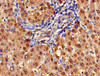 Immunohistochemistry of paraffin-embedded human liver tissue using CSB-PA002005DA01HU at dilution of 1:100
