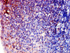 Immunohistochemistry of paraffin-embedded human tonsil tissue using CSB-PA002126LA01HU at dilution of 1:100