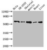 Western Blot<br />
 Positive WB detected in: Hela whole cell lysate, SH-SY5Y whole cell lysate, Mouse skeletal muscle tissue, Rat heart tissue, Rat liver tissue<br />
 All lanes: ASNS antibody at 2.7µg/ml<br />
 Secondary<br />
 Goat polyclonal to rabbit IgG at 1/50000 dilution<br />
 Predicted band size: 65, 63, 55 kDa<br />
 Observed band size: 65 kDa<br />