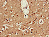 Immunohistochemistry of paraffin-embedded human brain tissue using CSB-PA002422LA01HU at dilution of 1:100
