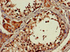 Immunohistochemistry of paraffin-embedded human testis tissue using CSB-PA002422LA01HU at dilution of 1:100