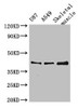 Western Blot<br />
 Positive WB detected in: U87 whole cell lysate, A549 whole cell lysate, Mouse skeletal muscle tissue<br />
 All lanes: B3GALT4 antibody at 3µg/ml<br />
 Secondary<br />
 Goat polyclonal to rabbit IgG at 1/50000 dilution<br />
 Predicted band size: 42 kDa<br />
 Observed band size: 42 kDa<br />