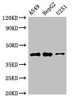 Western Blot<br />
 Positive WB detected in: A549 whole cell lysate, HepG2 whole cell lysate, U251 whole cell lysate<br />
 All lanes: B4GALT2 antibody at 3.5µg/ml<br />
 Secondary<br />
 Goat polyclonal to rabbit IgG at 1/50000 dilution<br />
 Predicted band size: 42, 35, 45 kDa<br />
 Observed band size: 42 kDa<br /> Western Blot<br />
 Positive WB detected in: A549 whole cell lysate, HepG2 whole cell lysate, U251 whole cell lysate<br />
 All lanes: B4GALT2 antibody at 3.5µg/ml<br />
 Secondary<br />
 Goat polyclonal to rabbit IgG at 1/50000 dilution<br />
 Predicted band size: 42, 35, 45 kDa<br />
 Observed band size: 42 kDa<br />