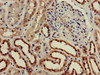 Immunohistochemistry of paraffin-embedded human kidney tissue using CSB-PA005307LA01HU at dilution of 1:100