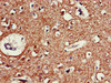 Immunohistochemistry of paraffin-embedded human brain tissue using CSB-PA005385LA01HU at dilution of 1:100