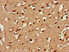 Immunohistochemistry of paraffin-embedded human brain tissue using CSB-PA005552LA01HU at dilution of 1:100