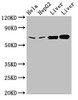 Western Blot<br />
 Positive WB detected in: Hela whole cell lysate, HepG2 whole cell lysate, Rat liver tissue, Mouse liver tissue<br />
 All lanes: CLINT1 antibody at 2µg/ml<br />
 Secondary<br />
 Goat polyclonal to rabbit IgG at 1/50000 dilution<br />
 Predicted band size: 69, 71 kDa<br />
 Observed band size: 69 kDa<br />