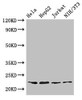 Western Blot<br />
 Positive WB detected in: Hela whole cell lysate, HepG2 whole cell lysate, Jurkat whole cell lysate, NIH/3T3 whole cell lysate<br />
 All lanes: RPS5 antibody at 3.2µg/ml<br />
 Secondary<br />
 Goat polyclonal to rabbit IgG at 1/50000 dilution<br />
 Predicted band size: 23 kDa<br />
 Observed band size: 23 kDa<br />