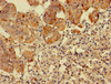 Immunohistochemistry of paraffin-embedded human adrenal gland tissue using CSB-PA00729A0Rb at dilution of 1:100