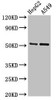 Western Blot<br />
 Positive WB detected in: HepG2 whole cell lysate, A549 whole cell lysate<br />
 All lanes: GLRA1 antibody at 2.7µg/ml<br />
 Secondary<br />
 Goat polyclonal to rabbit IgG at 1/50000 dilution<br />
 Predicted band size: 53, 52 kDa<br />
 Observed band size: 53 kDa<br /> Western Blot<br />
 Positive WB detected in: HepG2 whole cell lysate, A549 whole cell lysate<br />
 All lanes: GLRA1 antibody at 2.7µg/ml<br />
 Secondary<br />
 Goat polyclonal to rabbit IgG at 1/50000 dilution<br />
 Predicted band size: 53, 52 kDa<br />
 Observed band size: 53 kDa<br />