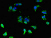 Immunofluorescent analysis of MCF-7 cells using CSB-PA009516LA01HU at dilution of 1:100 and Alexa Fluor 488-congugated AffiniPure Goat Anti-Rabbit IgG (H+L) Immunofluorescent analysis of MCF-7 cells using CSB-PA009516LA01HU at dilution of 1:100 and Alexa Fluor 488-congugated AffiniPure Goat Anti-Rabbit IgG (H+L)