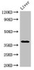 Western Blot<br />
 Positive WB detected in: Rat liver tissue<br />
 All lanes: PRKAG1 antibody at 3µg/ml<br />
 Secondary<br />
 Goat polyclonal to rabbit IgG at 1/50000 dilution<br />
 Predicted band size: 38, 35, 39 kDa<br />
 Observed band size: 38 kDa<br />