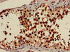 Immunohistochemistry of paraffin-embedded human testis tissue using CSB-PA01149A0Rb at dilution of 1:100