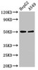 Western Blot<br />
 Positive WB detected in: HepG2 whole cell lysate, A549 whole cell lysate<br />
 All lanes: KIR3DL1 antibody at 2.5µg/ml<br />
 Secondary<br />
 Goat polyclonal to rabbit IgG at 1/50000 dilution<br />
 Predicted band size: 50, 39 kDa<br />
 Observed band size: 50 kDa<br />