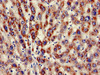 Immunohistochemistry of paraffin-embedded human liver tissue using CSB-PA012364LA01HU at dilution of 1:100