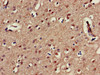 Immunohistochemistry of paraffin-embedded human brain tissue using CSB-PA012364LA01HU at dilution of 1:100