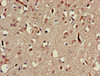Immunohistochemistry of paraffin-embedded human brain tissue using CSB-PA013421LA01HU at dilution of 1:100