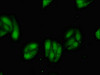 Immunofluorescent analysis of HepG2 cells using CSB-PA013792LA01HU at dilution of 1:100 and Alexa Fluor 488-congugated AffiniPure Goat Anti-Rabbit IgG (H+L) Immunofluorescent analysis of HepG2 cells using CSB-PA013792LA01HU at dilution of 1:100 and Alexa Fluor 488-congugated AffiniPure Goat Anti-Rabbit IgG (H+L)