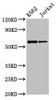 Western Blot<br />
 Positive WB detected in: K562 whole cell lysate, Jurkat whole cell lysate<br />
 All lanes: NAMPT antibody at 2.7µg/ml<br />
 Secondary<br />
 Goat polyclonal to rabbit IgG at 1/50000 dilution<br />
 Predicted band size: 56 kDa<br />
 Observed band size: 56 kDa<br />