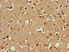 Immunohistochemistry of paraffin-embedded human brain tissue using CSB-PA017298LA01HU at dilution of 1:100