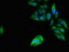 Immunofluorescent analysis of Hela cells using CSB-PA017788LA01HU at dilution of 1:100 and Alexa Fluor 488-congugated AffiniPure Goat Anti-Rabbit IgG (H+L)