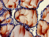 Immunohistochemistry of paraffin-embedded human thyroid tissue using CSB-PA018206LA01HU at dilution of 1:100