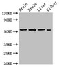 Western Blot<br />
 Positive WB detected in: Rat brain tissue, Mouse brain tissue, Mouse liver tissue, Mouse kidney tissue<br />
 All lanes: PPP2R2A antibody at 3µg/ml<br />
 Secondary<br />
 Goat polyclonal to rabbit IgG at 1/50000 dilution<br />
 Predicted band size: 52, 53 kDa<br />
 Observed band size: 52 kDa<br />