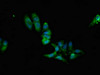 Immunofluorescent analysis of Hela cells using CSB-PA018564LA01HU at dilution of 1:100 and Alexa Fluor 488-congugated AffiniPure Goat Anti-Rabbit IgG (H+L)