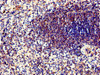 Immunohistochemistry of paraffin-embedded human spleen tissue using CSB-PA018583LA01HU at dilution of 1:100